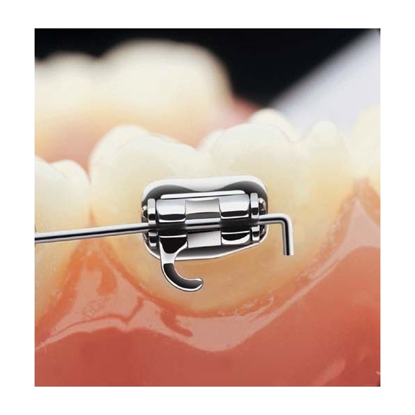SmartClip tub molar
