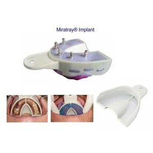 miratray implant